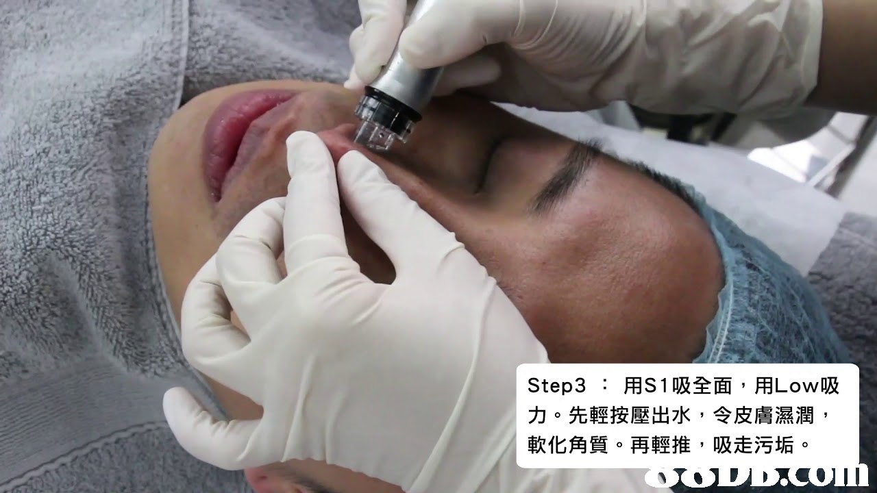 Step3 :用S1吸全面,用Low吸 力。先輕按壓出水,令皮膚濕潤 軟化角質。再輕推,吸走污垢。  Medical procedure,Skin,Face,Nose,Eyebrow