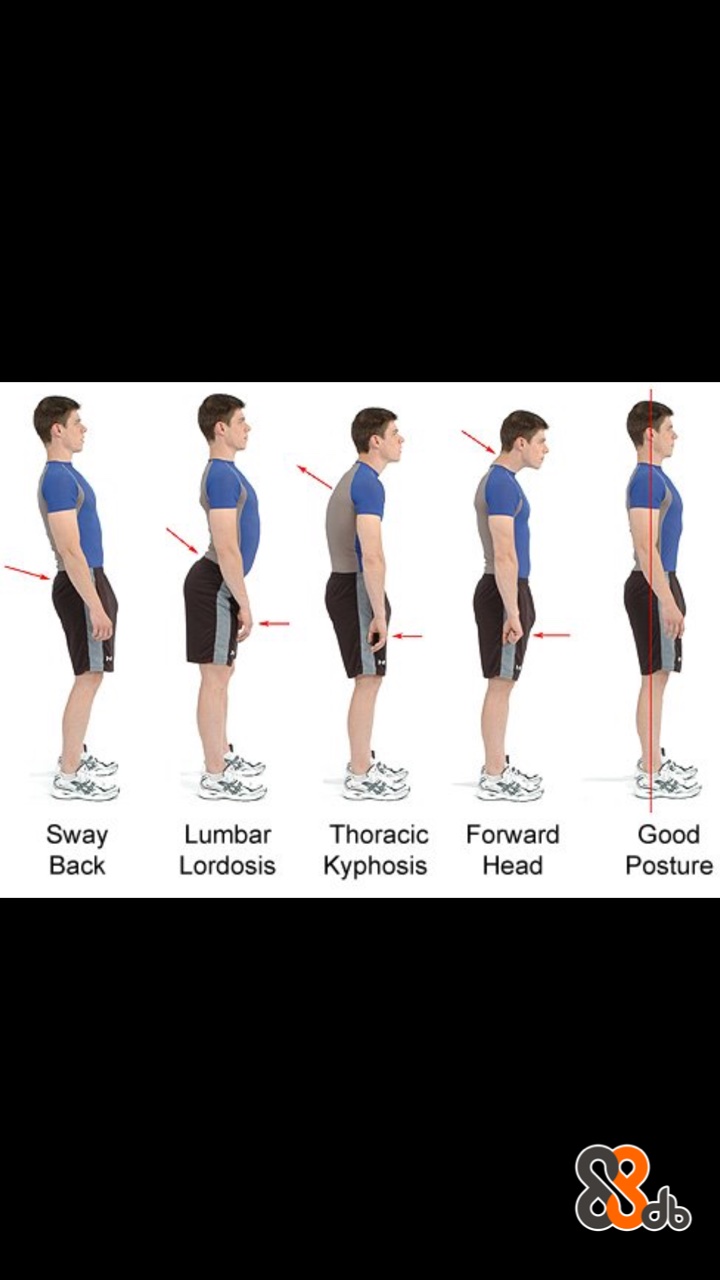 Sway Lumba Thoracic Forward Good Lordosis Kyphosis Head Back Posture  Standing,Shoulder,Joint,Physical fitness,Exercise equipment